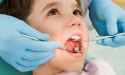 Çocuklarda Diş Çürüğü: Önlenmesi ve Belirtileri