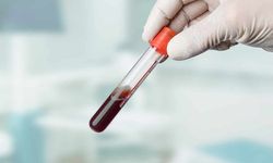 A Kan Grubunun Felç Riski Artıyor: ABD'de Yapılan Araştırma
