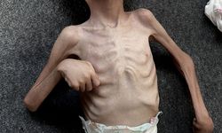 UNRWA Genel Komiseri Lazzarini: “Gazze’de Güvenli Bir Yer Yok, Açlık Sessiz Bir Ölüm Getiriyor”