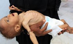 Gazze'de açlıktan ölen çocuk sayısı 96’ya ulaştı.