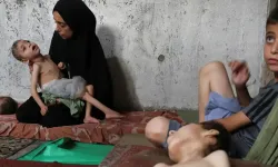 Gazze’de Açlıktan Ölümler Artıyor: 147’si Çocuk, 442 Şehit