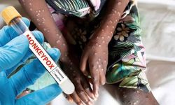 Mpox salgını için küresel acil durum sona erdi.