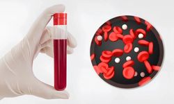 Bilim İnsanları Yeni Bir Kan Grubu Sistemi Keşfetti