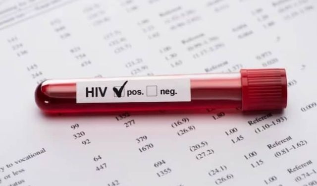 Türkiye'de HIV vakalarında artış eğilimi devam ediyor: Dünya Sağlık Örgütü'ne göre, Türkiye'deki 'gizli pandemi' HIV!