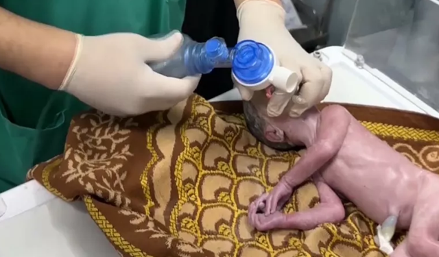 Gazze'de Yaralanan Hamile Kadının Karnındaki Bebek Kurtarıldı