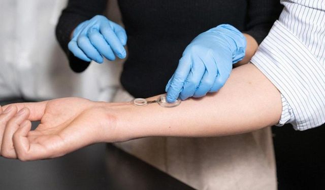 Enfeksiyonları günler öncesinden tespit eden akıllı bandaj: iCares