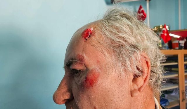 Salda'da Sahipsiz Köpek Dehşeti: Bakkala Giderken Saldırıya Uğradı