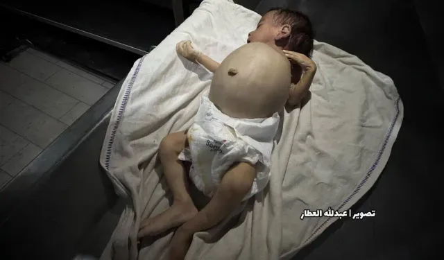 “Gazze’de açlık bir silah gibi: Şehid sayısı 281’e çıktı”
