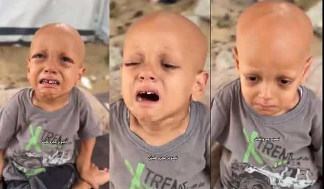 Yemin ederim açım” diyen Gazzeli Abdullah Türkiye’de hayatını kaybetti