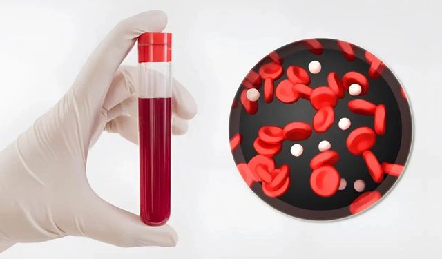 Bilim İnsanları Yeni Bir Kan Grubu Sistemi Keşfetti