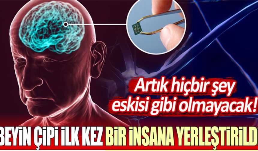 Elon Musk'ın Şirketi Neuralink İle İlk İnsanın Beyin Çipi İmplantı Gerçekleşti!