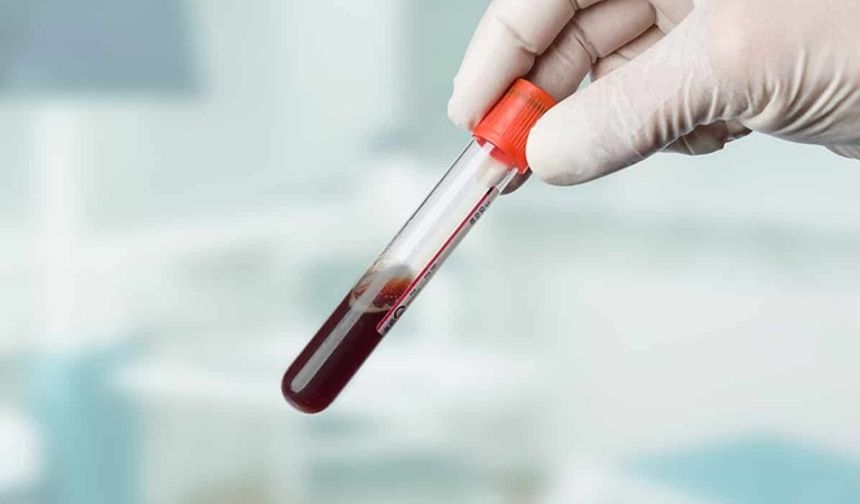 A Kan Grubunun Felç Riski Artıyor: ABD'de Yapılan Araştırma