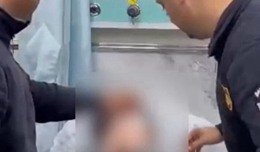 Fermuara Sıkışan Göz Kapağıyla Hastanelik Oldu
