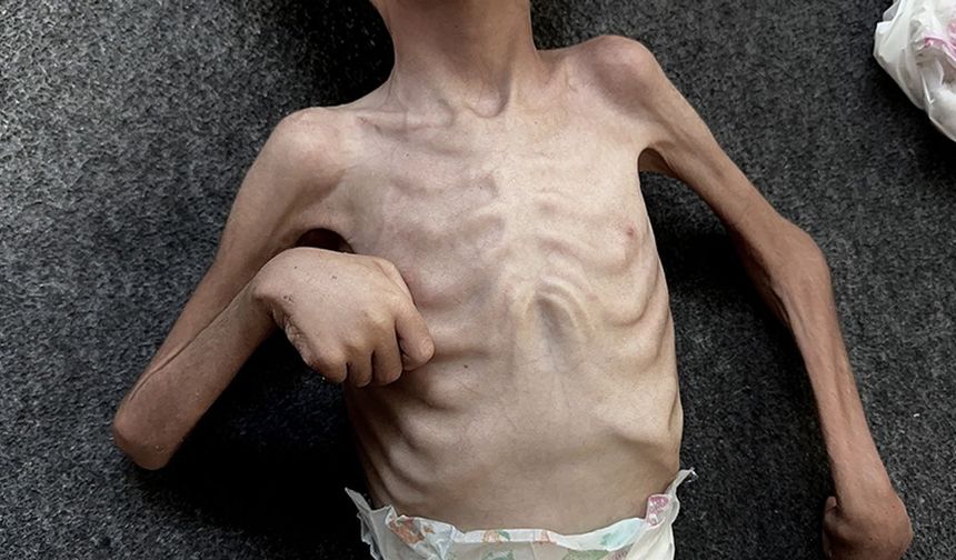 UNRWA Genel Komiseri Lazzarini: “Gazze’de Güvenli Bir Yer Yok, Açlık Sessiz Bir Ölüm Getiriyor”