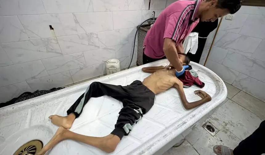 Gazze’de Ölüm Sessizliği: 10 Kişi Daha Açlıktan Hayatını Kaybetti